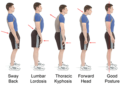 illustration of posture poses